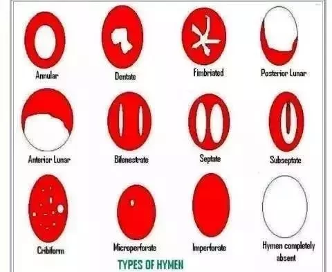 处女膜知识合辑